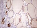 ABCB1 Antibody in Immunohistochemistry (Paraffin) (IHC (P))