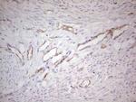 ABCB1 Antibody in Immunohistochemistry (Paraffin) (IHC (P))