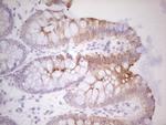 ABCB1 Antibody in Immunohistochemistry (Paraffin) (IHC (P))