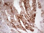 ABCB1 Antibody in Immunohistochemistry (Paraffin) (IHC (P))