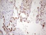 ABCB1 Antibody in Immunohistochemistry (Paraffin) (IHC (P))