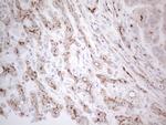 ABCB1 Antibody in Immunohistochemistry (Paraffin) (IHC (P))