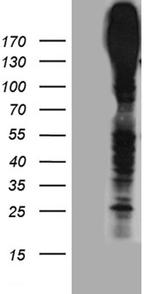 ABCC3 Antibody in Western Blot (WB)