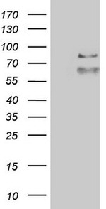 ABCD1 Antibody in Western Blot (WB)