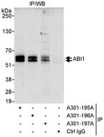 ABI1 Antibody in Immunoprecipitation (IP)
