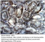 ABL1 Antibody in Immunohistochemistry (IHC)