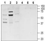 TGR5 (GPBAR1) Antibody in Western Blot (WB)