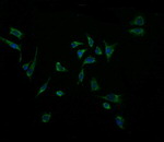 ACAA2 Antibody in Immunocytochemistry (ICC/IF)