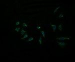 ACAA2 Antibody in Immunocytochemistry (ICC/IF)