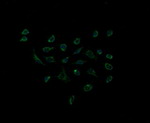 ACAA2 Antibody in Immunocytochemistry (ICC/IF)