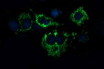 ACAA2 Antibody in Immunocytochemistry (ICC/IF)