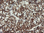 ACAA2 Antibody in Immunohistochemistry (Paraffin) (IHC (P))