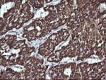 ACAA2 Antibody in Immunohistochemistry (Paraffin) (IHC (P))