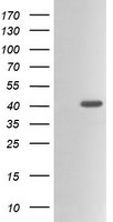 ACAA2 Antibody in Western Blot (WB)