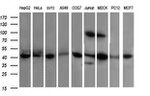 ACAA2 Antibody in Western Blot (WB)