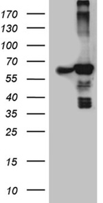 ACAD9 Antibody in Western Blot (WB)
