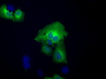 ACAT2 Antibody in Immunocytochemistry (ICC/IF)