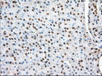 ACAT2 Antibody in Immunohistochemistry (Paraffin) (IHC (P))