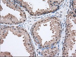 ACAT2 Antibody in Immunohistochemistry (Paraffin) (IHC (P))