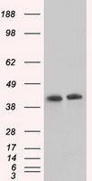 ACAT2 Antibody in Western Blot (WB)