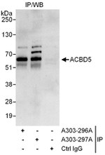 ACBD5 Antibody in Immunoprecipitation (IP)