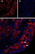 TRPV1 (VR1) Antibody in Immunohistochemistry (IHC)