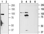 TRPA1 (extracellular) Antibody in Western Blot (WB)