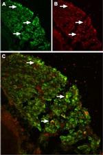 TRPV2 (VRL1) (extracellular) Antibody in Immunohistochemistry (IHC)