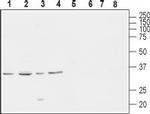 CACNG4 Antibody in Western Blot (WB)