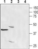 CRACR2A (EFCAB4B) Antibody in Western Blot (WB)