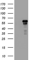 ACD Antibody in Western Blot (WB)