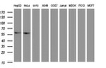 ACD Antibody in Western Blot (WB)