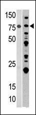 Aconitase 2 Antibody in Western Blot (WB)