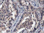 ACOT12 Antibody in Immunohistochemistry (Paraffin) (IHC (P))