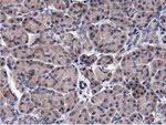 ACOT12 Antibody in Immunohistochemistry (Paraffin) (IHC (P))