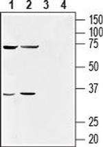 GPR55 (extracellular) Antibody in Western Blot (WB)