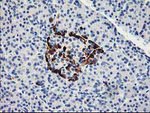 ACSS2 Antibody in Immunohistochemistry (Paraffin) (IHC (P))