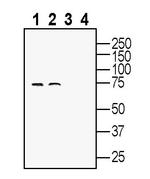 SLC22A2 (OCT2) Antibody in Western Blot (WB)
