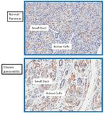 alpha Actinin 2 Antibody in Immunohistochemistry (IHC)