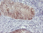 ACY1 Antibody in Immunohistochemistry (Paraffin) (IHC (P))