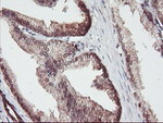 ACY1 Antibody in Immunohistochemistry (Paraffin) (IHC (P))