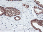 ACY1 Antibody in Immunohistochemistry (Paraffin) (IHC (P))