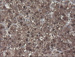 ACY1 Antibody in Immunohistochemistry (Paraffin) (IHC (P))