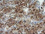 ACY1 Antibody in Immunohistochemistry (Paraffin) (IHC (P))