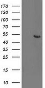 ACY1 Antibody in Western Blot (WB)