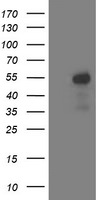 ACY1 Antibody in Western Blot (WB)