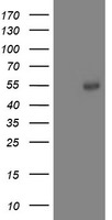 ACY1 Antibody in Western Blot (WB)