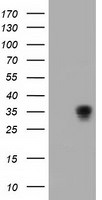 ACY3 Antibody in Western Blot (WB)