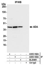 ADA/Adenosine Deaminase Antibody in Western Blot (WB)