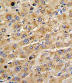 ADAMTS13 Antibody in Immunohistochemistry (IHC)